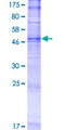 TMEM45B Protein - 12.5% SDS-PAGE of human TMEM45B stained with Coomassie Blue