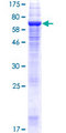 TMEM49 Protein - 12.5% SDS-PAGE of human TMEM49 stained with Coomassie Blue