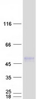TMEM51 Protein - Purified recombinant protein TMEM51 was analyzed by SDS-PAGE gel and Coomassie Blue Staining