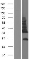 TMEM54 Protein - Western validation with an anti-DDK antibody * L: Control HEK293 lysate R: Over-expression lysate