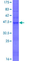 TMEM54 Protein - 12.5% SDS-PAGE of human TMEM54 stained with Coomassie Blue
