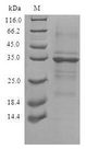 TMEM59 Protein - (Tris-Glycine gel) Discontinuous SDS-PAGE (reduced) with 5% enrichment gel and 15% separation gel.