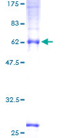 TMEM59 Protein - 12.5% SDS-PAGE of human C1orf8 stained with Coomassie Blue