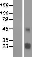 TMEM61 Protein - Western validation with an anti-DDK antibody * L: Control HEK293 lysate R: Over-expression lysate