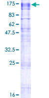 TMEM63A Protein - 12.5% SDS-PAGE of human TMEM63A stained with Coomassie Blue