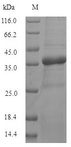 TMEM65 Protein - (Tris-Glycine gel) Discontinuous SDS-PAGE (reduced) with 5% enrichment gel and 15% separation gel.