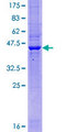 TMEM65 Protein - 12.5% SDS-PAGE of human TMEM65 stained with Coomassie Blue