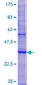 TMEM68 Protein - 12.5% SDS-PAGE of human TMEM68 stained with Coomassie Blue