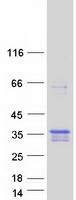 TMEM74B / C20orf46 Protein - Purified recombinant protein TMEM74B was analyzed by SDS-PAGE gel and Coomassie Blue Staining