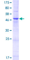 TMEM81 Protein - 12.5% SDS-PAGE of human TMEM81 stained with Coomassie Blue
