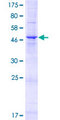 TMEM81 Protein - 12.5% SDS-PAGE of human TMEM81 stained with Coomassie Blue