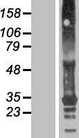 TMEM82 Protein - Western validation with an anti-DDK antibody * L: Control HEK293 lysate R: Over-expression lysate