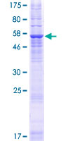 TMEM82 Protein - 12.5% SDS-PAGE of human TMEM82 stained with Coomassie Blue