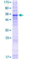 TMEM82 Protein - 12.5% SDS-PAGE of human TMEM82 stained with Coomassie Blue