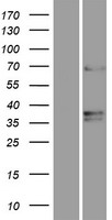 TMEM87A Protein - Western validation with an anti-DDK antibody * L: Control HEK293 lysate R: Over-expression lysate