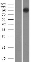 TMEM87B Protein - Western validation with an anti-DDK antibody * L: Control HEK293 lysate R: Over-expression lysate