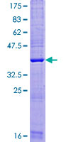TMEM88 Protein - 12.5% SDS-PAGE of human TMEM88 stained with Coomassie Blue