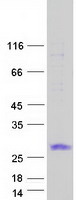 TMEM88 Protein - Purified recombinant protein TMEM88 was analyzed by SDS-PAGE gel and Coomassie Blue Staining