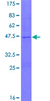 TMEM89 Protein - 12.5% SDS-PAGE of human TMEM89 stained with Coomassie Blue