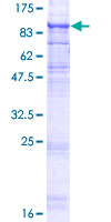 TMEM8A Protein - 12.5% SDS-PAGE of human TMEM8 stained with Coomassie Blue