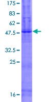 TMEM8B / NGX6 Protein - 12.5% SDS-PAGE of human C9orf127 stained with Coomassie Blue