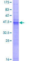 TMEM9 Protein - 12.5% SDS-PAGE of human TMEM9 stained with Coomassie Blue
