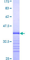 TMEPAI / PMEPA1 Protein - 12.5% SDS-PAGE Stained with Coomassie Blue.