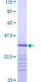 TMEPAI / PMEPA1 Protein - 12.5% SDS-PAGE Stained with Coomassie Blue.