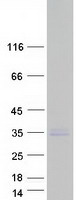 TMEPAI / PMEPA1 Protein - Purified recombinant protein PMEPA1 was analyzed by SDS-PAGE gel and Coomassie Blue Staining