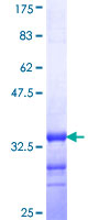 TMIE Protein - 12.5% SDS-PAGE Stained with Coomassie Blue.