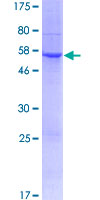 TMIGD1 Protein - 12.5% SDS-PAGE of human TMIGD1 stained with Coomassie Blue