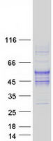 TMIGD2 Protein - Purified recombinant protein TMIGD2 was analyzed by SDS-PAGE gel and Coomassie Blue Staining