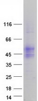 TMIGD2 Protein - Purified recombinant protein TMIGD2 was analyzed by SDS-PAGE gel and Coomassie Blue Staining