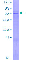 TMLHE / TMID Protein - 12.5% SDS-PAGE of human TMLHE stained with Coomassie Blue