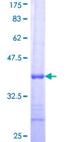 TMLHE / TMID Protein - 12.5% SDS-PAGE Stained with Coomassie Blue.