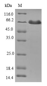 TMOD1 / Tropomodulin 1 Protein - (Tris-Glycine gel) Discontinuous SDS-PAGE (reduced) with 5% enrichment gel and 15% separation gel.
