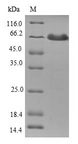 TMOD1 / Tropomodulin 1 Protein - (Tris-Glycine gel) Discontinuous SDS-PAGE (reduced) with 5% enrichment gel and 15% separation gel.