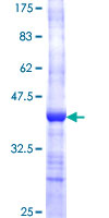 TMOD1 / Tropomodulin 1 Protein - 12.5% SDS-PAGE Stained with Coomassie Blue.
