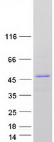 TMOD1 / Tropomodulin 1 Protein - Purified recombinant protein TMOD1 was analyzed by SDS-PAGE gel and Coomassie Blue Staining