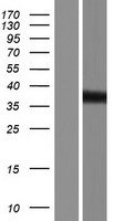 TMOD2 / Tropomodulin 2 Protein - Western validation with an anti-DDK antibody * L: Control HEK293 lysate R: Over-expression lysate