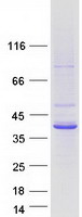 TMOD2 / Tropomodulin 2 Protein - Purified recombinant protein TMOD2 was analyzed by SDS-PAGE gel and Coomassie Blue Staining