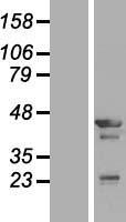 TMOD3 / Tropomodulin 3 Protein - Western validation with an anti-DDK antibody * L: Control HEK293 lysate R: Over-expression lysate