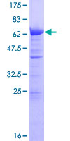 TMOD3 / Tropomodulin 3 Protein - 12.5% SDS-PAGE of human TMOD3 stained with Coomassie Blue