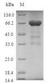 TMOD3 / Tropomodulin 3 Protein - (Tris-Glycine gel) Discontinuous SDS-PAGE (reduced) with 5% enrichment gel and 15% separation gel.