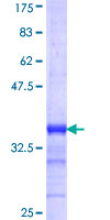 TMOD3 / Tropomodulin 3 Protein - 12.5% SDS-PAGE Stained with Coomassie Blue.