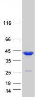 TMOD3 / Tropomodulin 3 Protein - Purified recombinant protein TMOD3 was analyzed by SDS-PAGE gel and Coomassie Blue Staining
