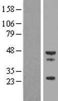 TMOD4 Protein - Western validation with an anti-DDK antibody * L: Control HEK293 lysate R: Over-expression lysate