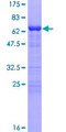 TMOD4 Protein - 12.5% SDS-PAGE of human TMOD4 stained with Coomassie Blue