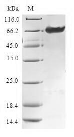 TMOD4 Protein - (Tris-Glycine gel) Discontinuous SDS-PAGE (reduced) with 5% enrichment gel and 15% separation gel.