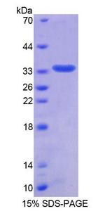 TMPO / TP / Thymopoietin Protein - Recombinant  Thymopoietin By SDS-PAGE